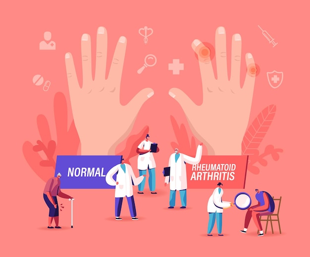 Concepto de artritis reumatoide. Pequeños personajes de doctor examinan mano enorme con patología y enfermedad de las articulaciones, tratamiento de enfermedades de brazos, paciente con chequeo de rodilla enfermo. Ilustración de Vector de gente de dibujos animados