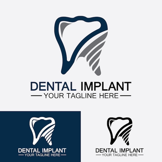 Concepto de diseños de vectores de logotipo de implante dental Plantilla de logotipo de ampCare de clínica dental