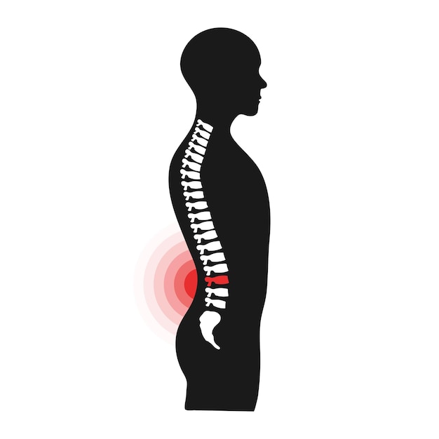 Vector concepto de dolor de espalda problema de salud de la columna vertebral humana círculo de dolor ilustración de medicina y atención médica