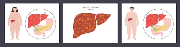 Concepto de enfermedad hepática