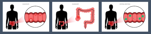 Vector concepto de enfermedades intestinales