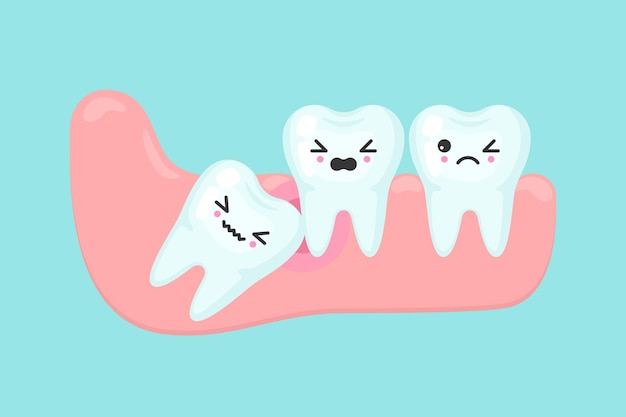 Concepto de estomatología dental de problemas de muelas del juicio. diente impactado dentro debajo de la encía inflamada