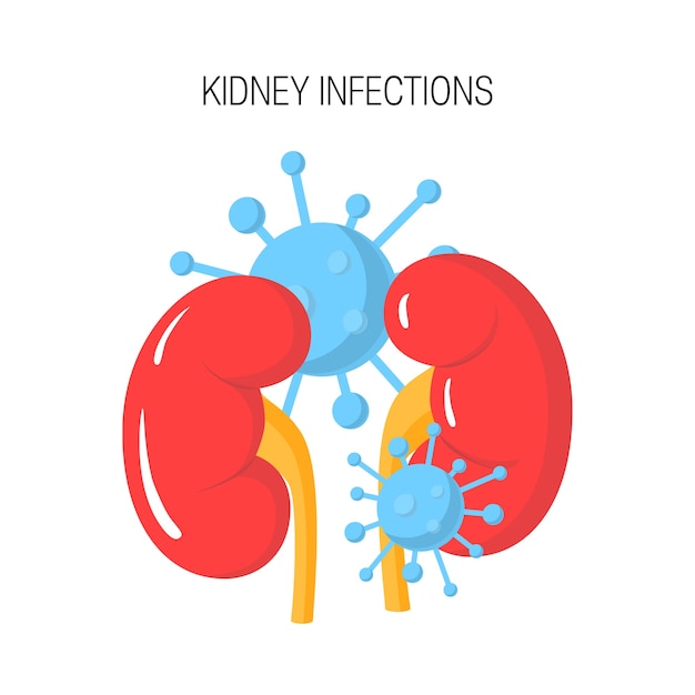 Vector concepto de infección renal aislado en blanco