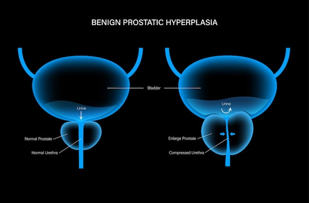 Vector concepto de información de hpb