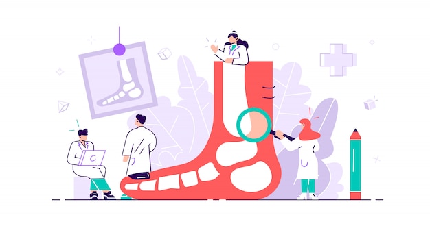 Concepto de podólogo. Traumatismo en pies y pies, patología y tratamiento de molestias por enfermedad con examen, cirugía o procedimientos. Pequeñas personas con enfermedades del pie, tobillo y extremidades inferiores. Ilustración plana