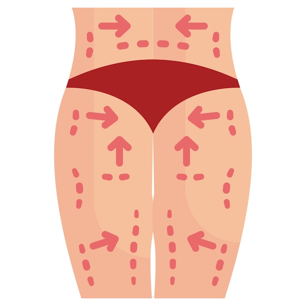 concepto de procedimiento de levantamiento de la parte inferior del cuerpo eliminar la piel redundante y flácida del vector de la espalda