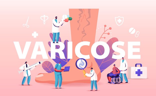 Concepto de tratamiento varicoso. ilustración de dibujos animados