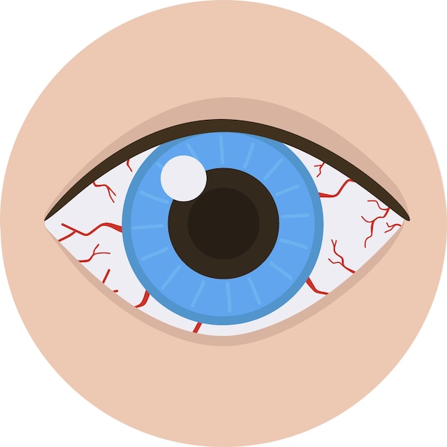 Vector conjuntivitis