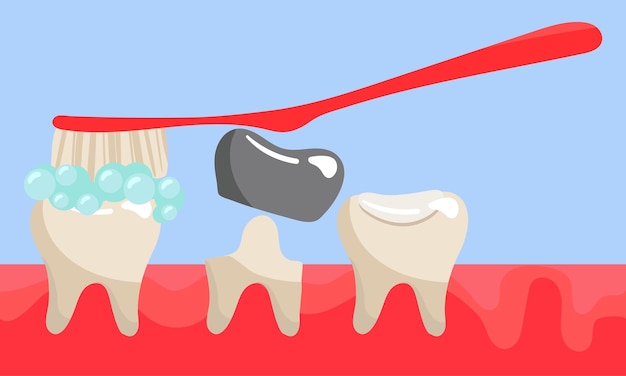 Vector un conjunto de dientes en las encías con un cepillo con una corona y limpian un sello y ningún diente limpian