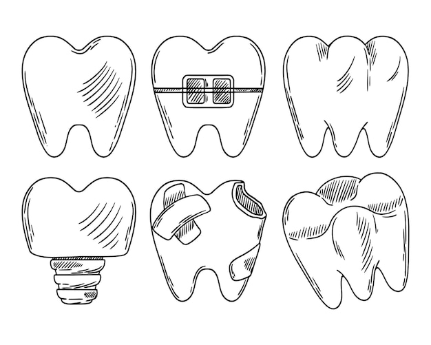 Conjunto de dientes vectoriales Esbozo de un diente para prótesis un diente con un aparello ortopédico un molar un diente Con coche