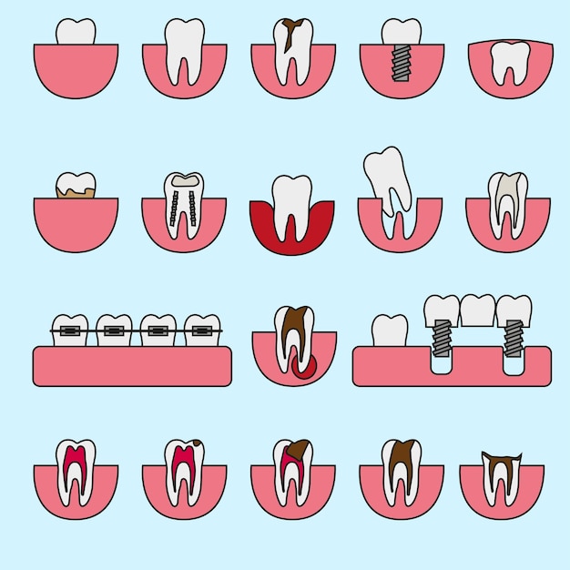 Vector conjunto de dientes