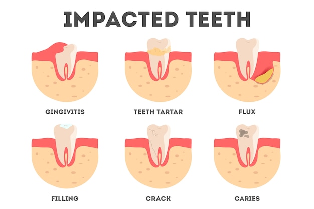 Conjunto de diferentes impactos en los dientes humanos. Enfermedades dentales y bucales. Idea de salud y tratamiento médico. ilustración