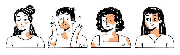 Vector conjunto de diferentes jóvenes con vitiligo colección de personajes en estilo doodle lineal