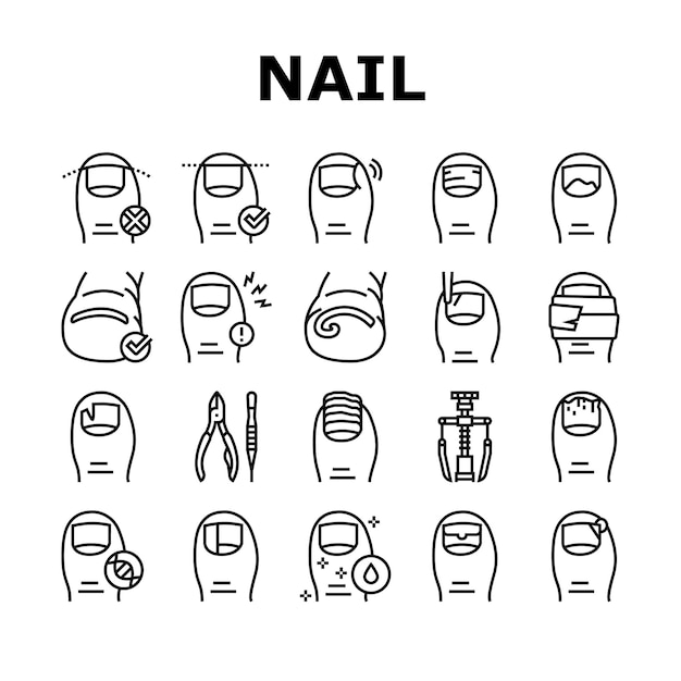 Conjunto de iconos de colección de enfermedades de uñas encarnadas Vector