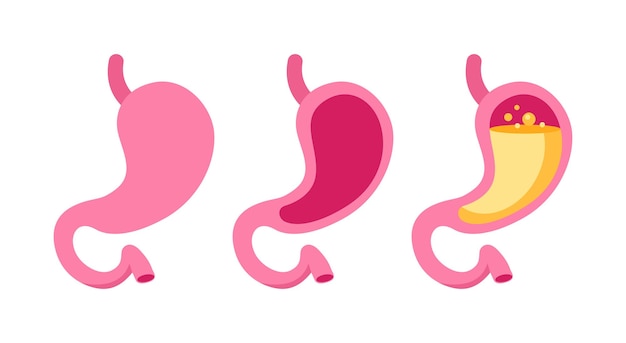 Vector conjunto de íconos estilizados del estómago en tonos de rosa que representan varios estados de salud del estomago