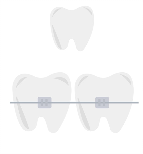 Vector conjunto de ilustraciones de vectores dentales para implantes dentales