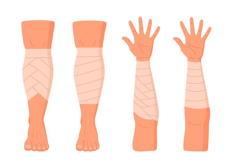 Vector conjunto de ilustraciones de vectores planos de vendaje de extremidades humanas vendajes de partes del cuerpo heridas de dibujos animados