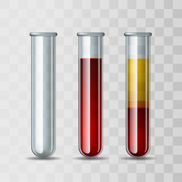 Conjunto de tubos de cristalería llenos de sangre vacíos y sangre fraccionada capas in vitro de glóbulos rojos