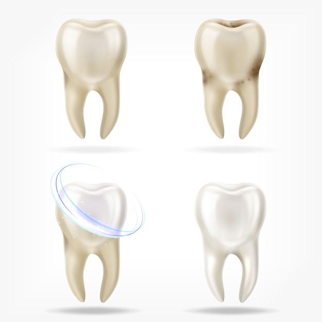 Conjunto de vector de diente limpio y sucio realista 3d, proceso de limpieza del diente.