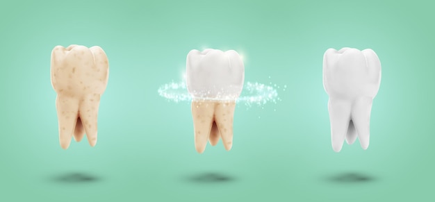 Vector conjunto vectorial de cuidado y protección de limpieza dental de tres molares