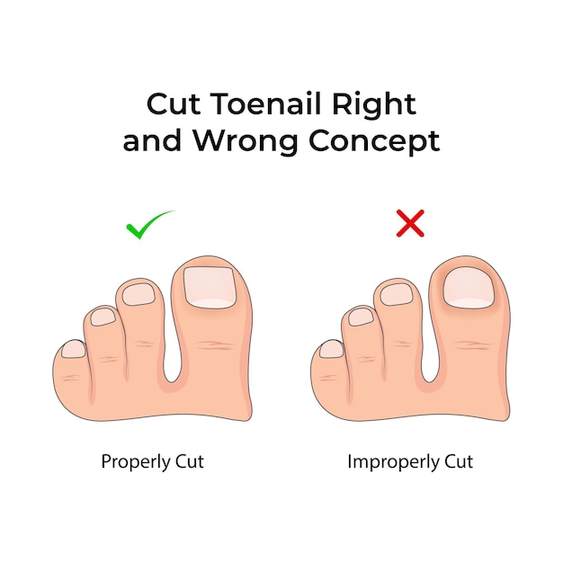 Cortar las uñas de los pies correctamente o incorrectamente Una guía para una ilustración vectorial de pies saludables