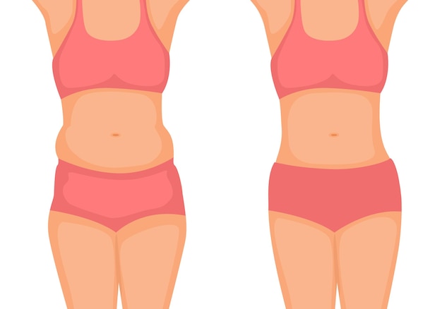 Vector cuerpo de mujer joven antes y después de la pérdida de peso que muestra desde la grasa hasta el concepto de grasa abdominal delgada