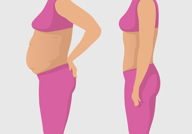 Cuerpo de mujer con vientre gordo y vientre tonificado antes y después del ejercicio para bajar de peso