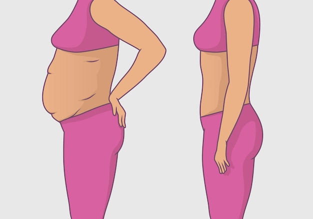 Vector cuerpo de mujer con vientre gordo y vientre tonificado antes y después del ejercicio para bajar de peso