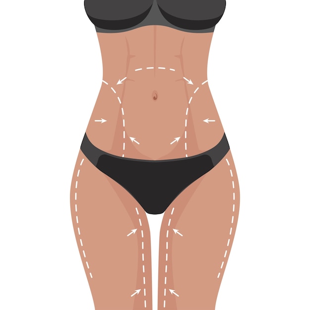 Vector cuerpo perfecto para adelgazar liposucción para perder peso.