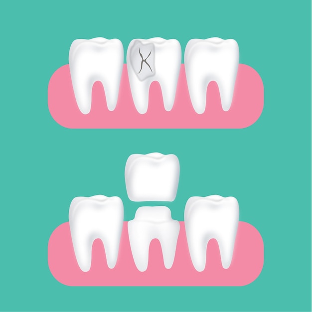 Vector cuidado dental de dibujos animados libre de vectores