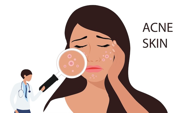 Dermatólogo revisando la cara de una mujer joven con piel acné granos puntos negros ilustración vectorial