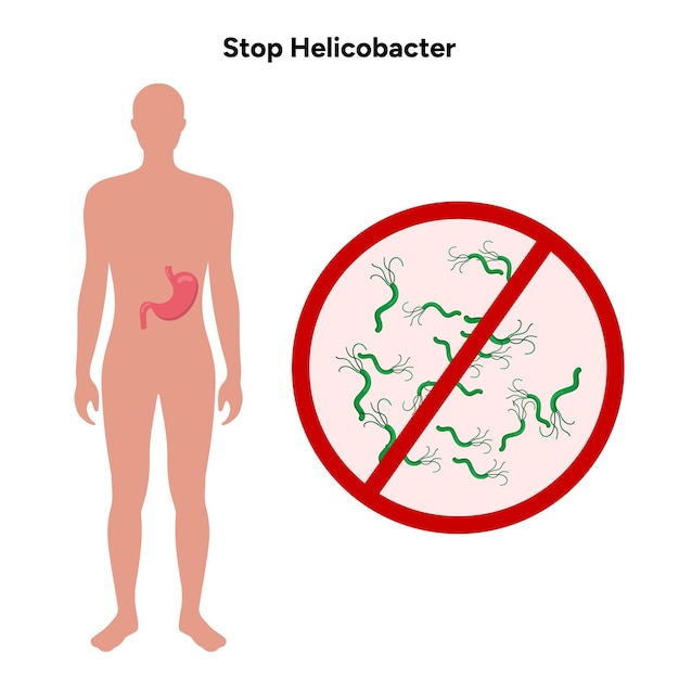 Detener el Helicobacter pylori