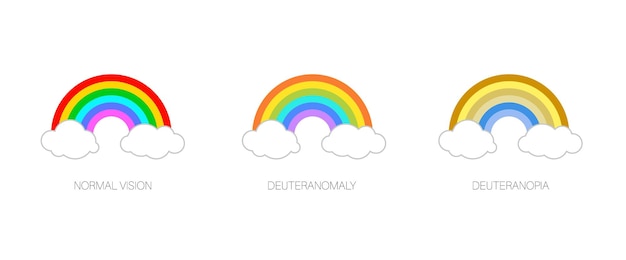 Vector deuteranomalía y deuteranopía