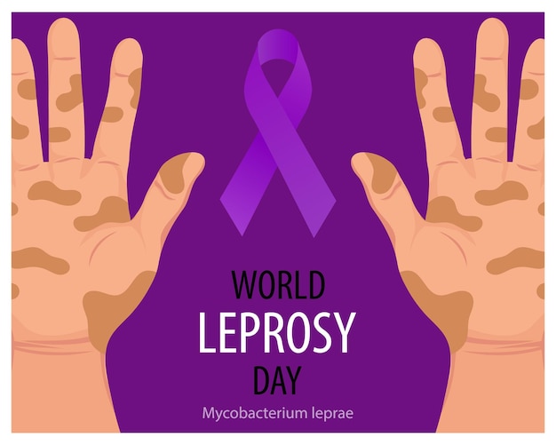 Día Mundial de la Lepra. Pancarta con manos enfermas y una cinta morada, símbolo de la lucha contra la lepra