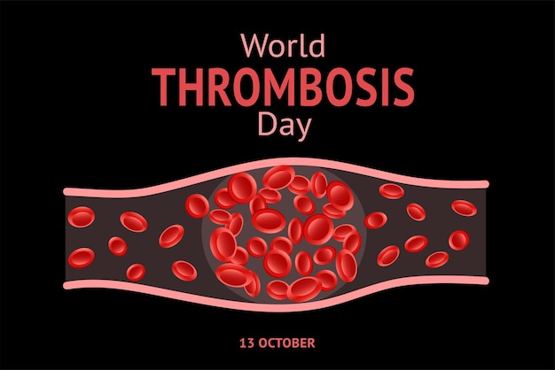 Día Mundial de la Trombosis 13 de octubre Ilustración vectorial de diseño con símbolo de Trombosis