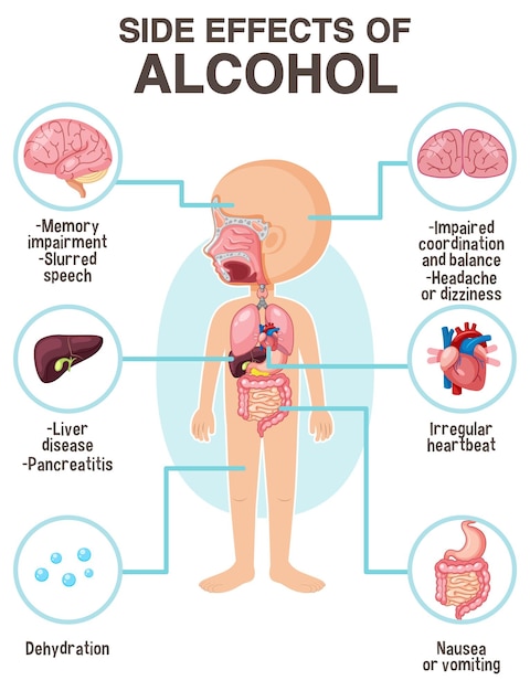 Vector diagrama de anatomía humana estilo de dibujos animados de los efectos secundarios del alcohol