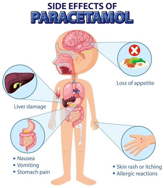 Diagrama de anatomía humana estilo de dibujos animados de efectos secundarios de paracetamol