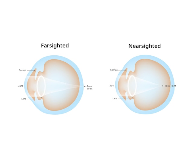 Diagrama de la visión de futuro y la visión de corto plazo