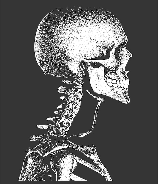 Un dibujo en blanco y negro de un cráneo humano con la cabeza y el cuello visibles.