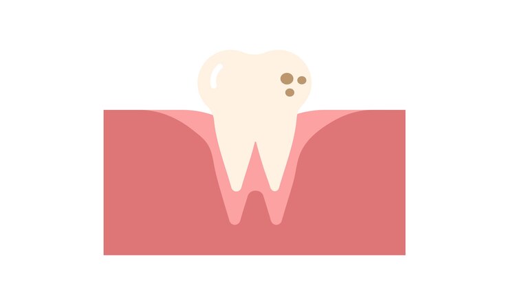 Vector diente con caries. la caries dental. diente malo. fondo de cuidado dental. dientes no saludables. diente vectorial