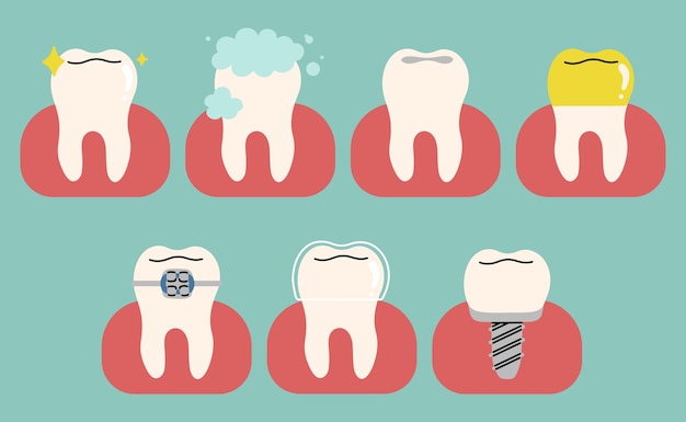 Dientes 1