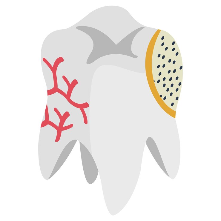 Vector dientes agrietados concepto isométrico diseño del icono vectorial del diente dañado o malo símbolo de prótesis dentales sanación oral