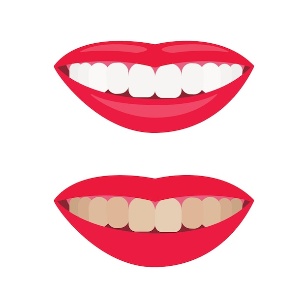 Dientes amarillos y limpios Limpieza de dientes