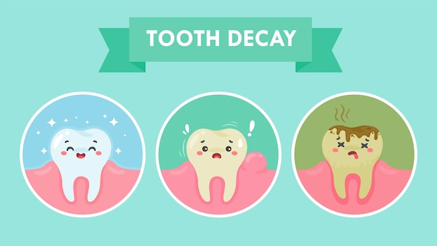 Los dientes de dibujos animados y las encías dentro de la boca están contentos con el problema de la caries dental. Hay placa en los dientes.