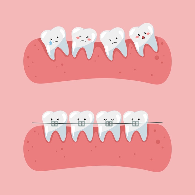 Dientes con frenillos Arte sobre el tema de la odontología infantil.