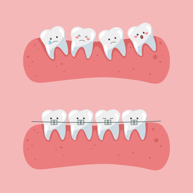 Dientes con frenillos arte sobre el tema de la odontología infantil.