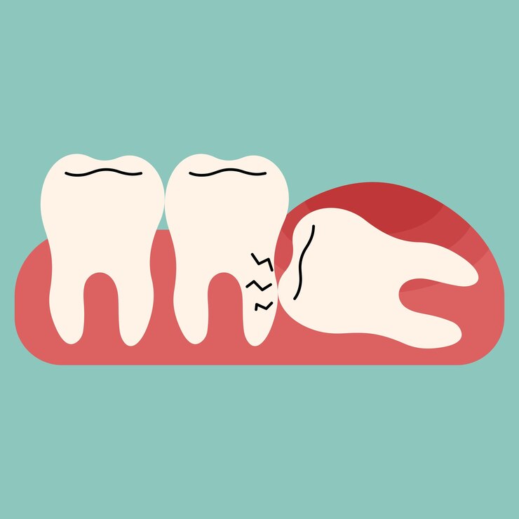 Vector dientes del juicio sencillo 3 lindo en una ilustración vectorial de fondo azul-verde