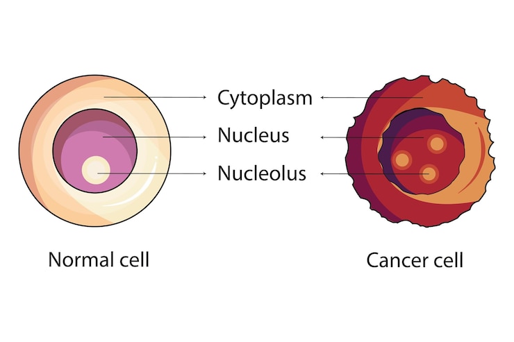 Vector diferencia entre un diagrama normal y un diagrama científico de células cancerosas