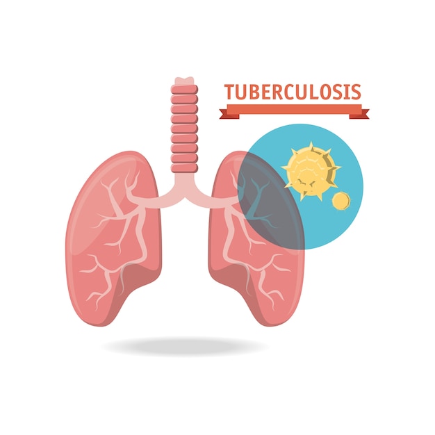 Vector diseño de concepto tubereculosis