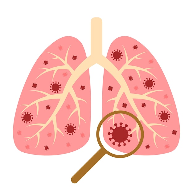 Diseño de coronavirus con enfermedad pulmonar y virus Síntomas de propagación de la enfermedad por coronavirus